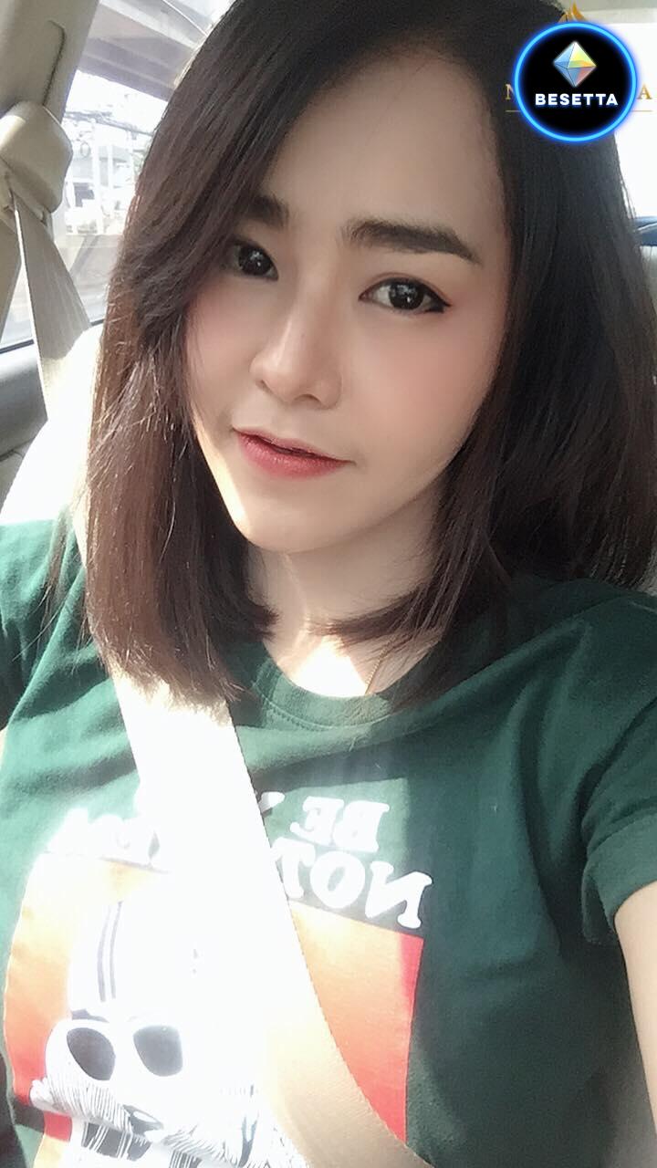 โบท็อกซ์ริ้วรอยจางลงอย่างเห็นได้ชัด หลังฉีด 1 สัปดาห์ก็ตึงแล้ววววว